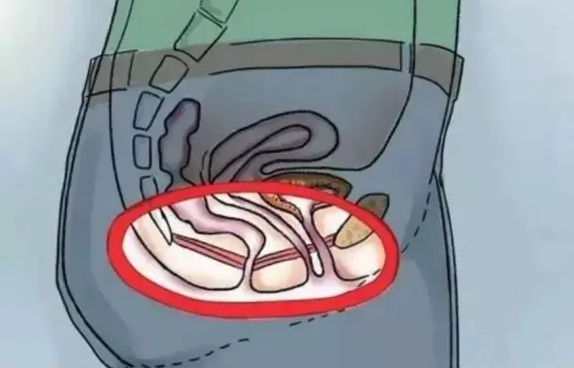 凯格尔运动，怎么真正入门？